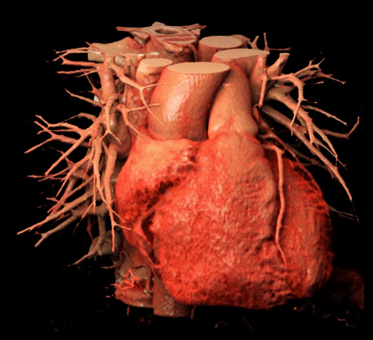 View in Anatomage table