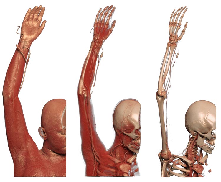 Anatomage table