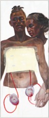 Painting of a woman who has just had surgery